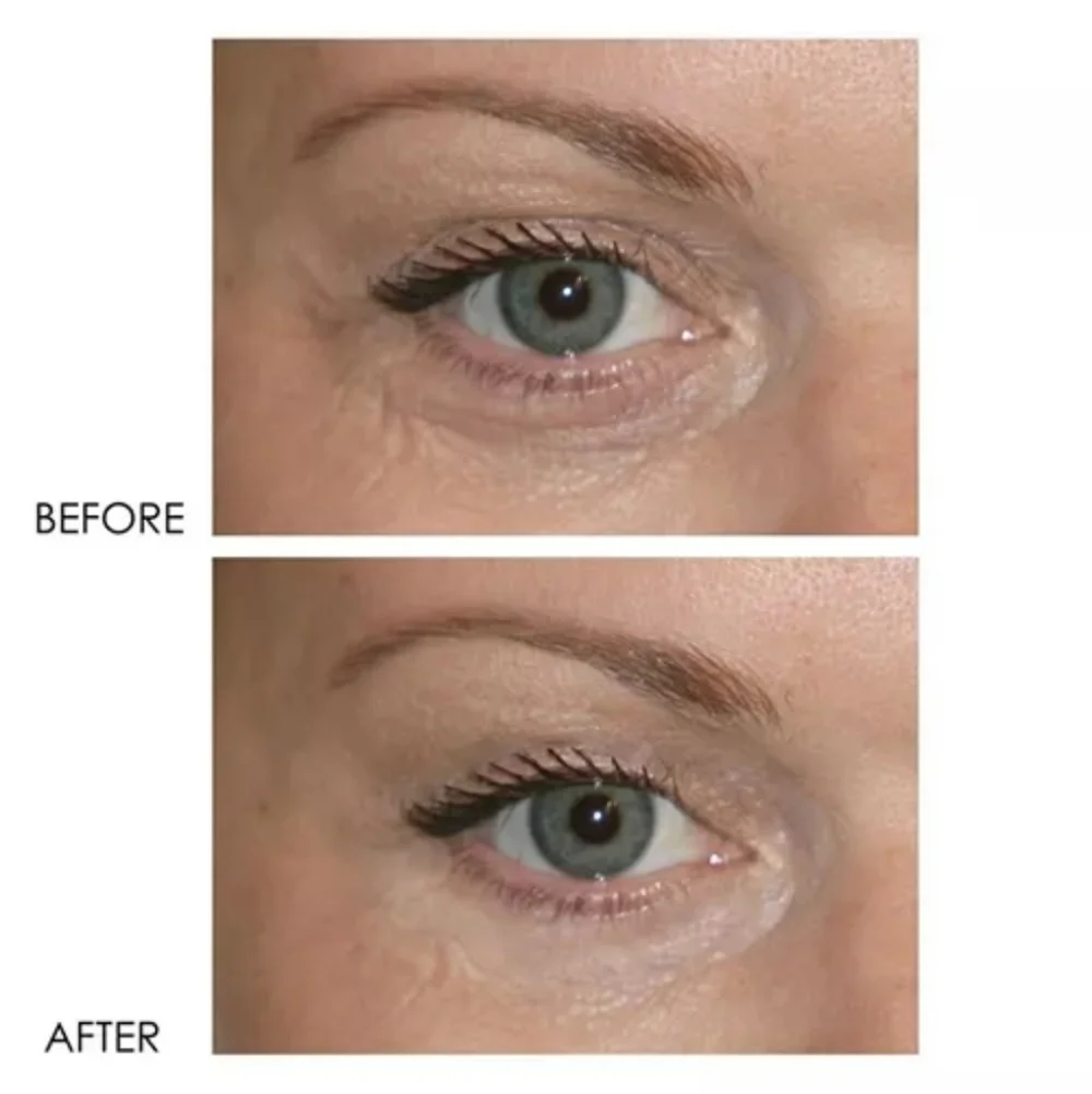 DERMELECT REVITALITE PROFESSIONAL Eyelid & Dark Circle Corrector 15 ML / 0.5 OZ